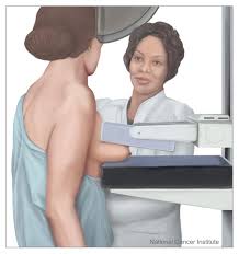 breast cancer screening mammogram